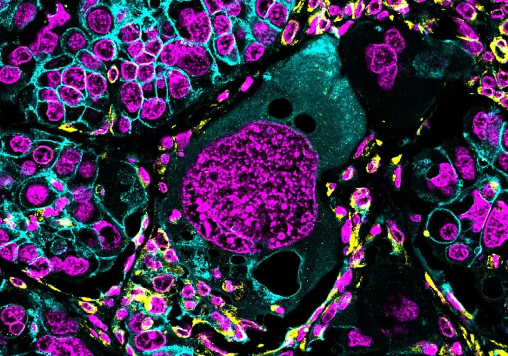 Dlaczego DNA przed podziałem to chromosomy - Chodzi o bezpieczeństwo