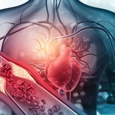 Anatomia człowieka: serce i zatkane naczynia krwionośne. Widok przekroju tętnicy z blaszką miażdżycową i czerwonymi krwinkami.