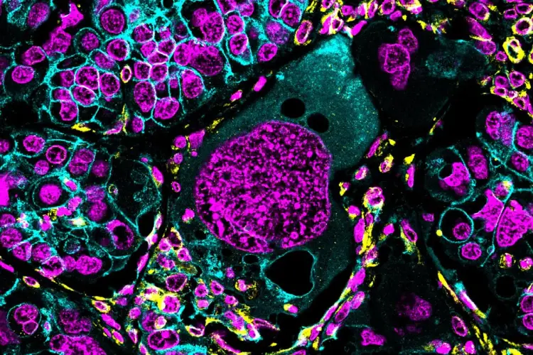 Dlaczego DNA przed podziałem to chromosomy - Chodzi o bezpieczeństwo
